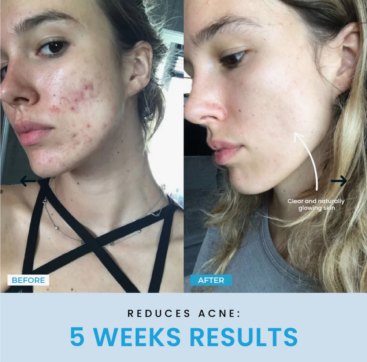 Vellar™ Facial Sculptor