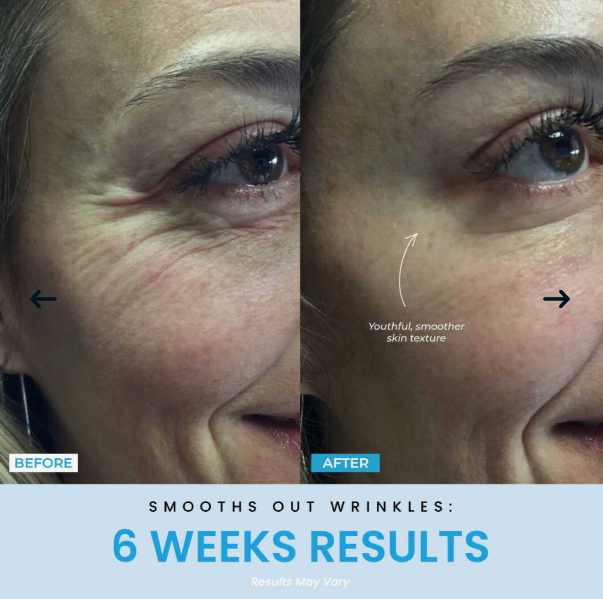 Vellar™ Facial Sculptor