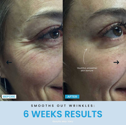 Vellar™ Facial Sculptor