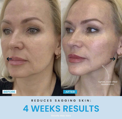 Vellar™ Facial Sculptor