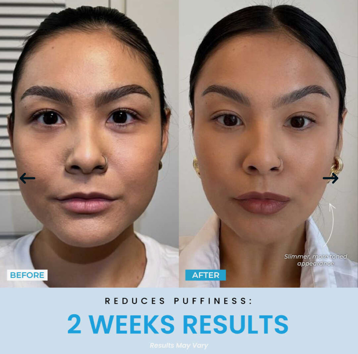 Vellar™ Facial Sculptor