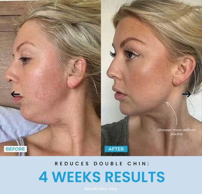 Vellar™ Facial Sculptor