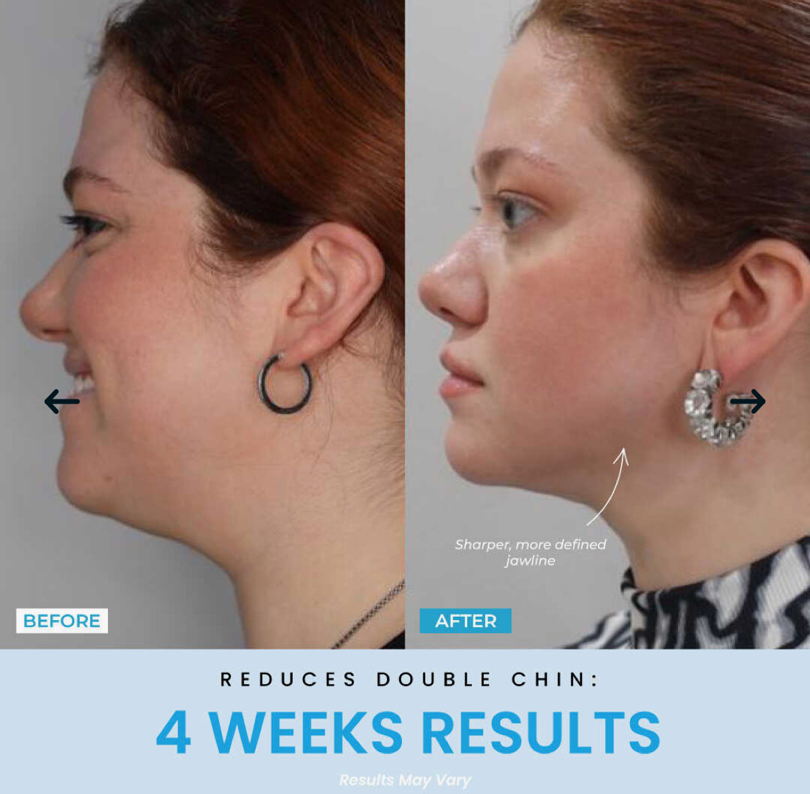 Vellar™ Facial Sculptor