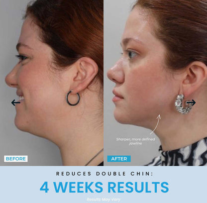 Vellar™ Facial Sculptor